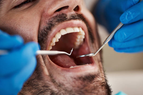 Best Emergency Dental Care for Trauma or Injury in Albemarle, NC