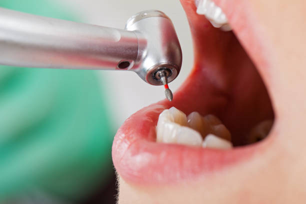 Best Emergency Treatment for Toothache in Albemarle, NC